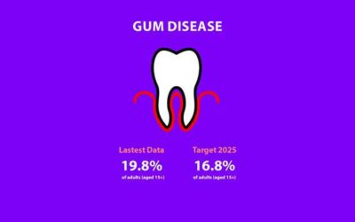 Gum Disease – Periodontitis