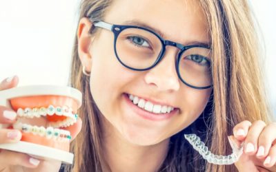 How Long Do Braces Take To Straighten Teeth?