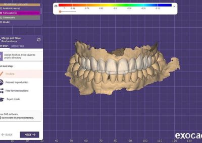 TeethGrinding Bruxism 4