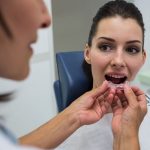 A woman sitting in a dental clinic chair opens her mouth as a dental professional holds a clear Invisalign aligner near her teeth, preparing to fit it.