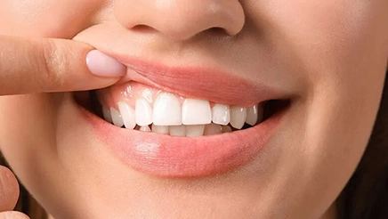 Gum Disease Treatment